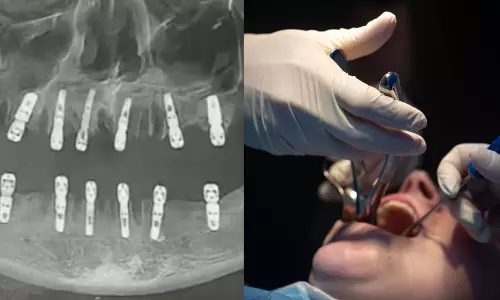 ஒரே நாளில் 23 பற்களையும் பிடுங்கிய மருத்துவர்கள்.. மாரடைப்பால் பறிபோன உயிர்