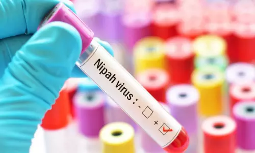 காரமடை அருகே சோதனைச்சாவடிகளில் நிபா வைரஸ் பரிசோதனை தீவிரம்