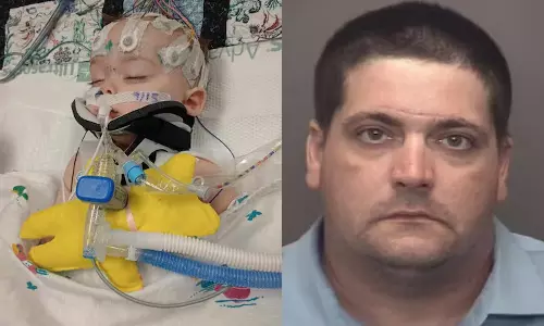 usa Man Sentenced To 16 Years In Jail After Rats Disfigure His Baby