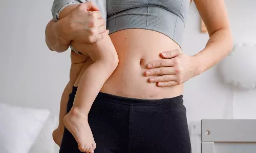 ஒரு பெண் எத்தனை முறை சிசேரியன் செய்து குழந்தை பெற்றுக்கொள்ள முடியும்?