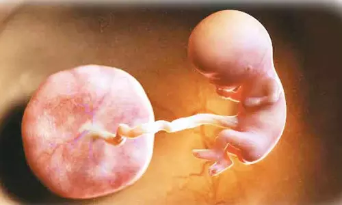 குழந்தையின் தொப்புள் கொடி பராமரிப்பு