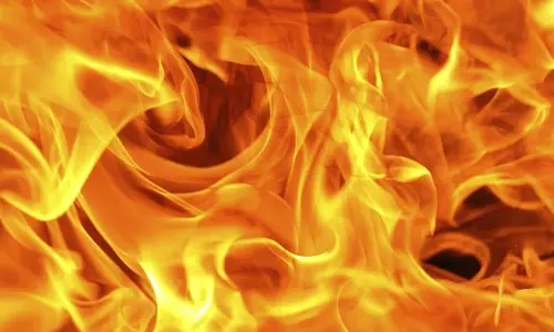 5 நாய் குட்டிகள் மீது பெட்ரோல் ஊற்றி எரித்த பெண்கள் மீது வழக்கு