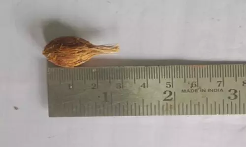 கும்பகோணம் அருகே விளைந்த `வினோத தேங்காய் ஆச்சரியத்துடன் கண்டு ரசித்த மக்கள்