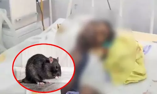 உயிரிழந்தவரின் கண்-ஐ காணவில்லை என புகார்- எலி கடித்திருக்கலாம் என கூறிய மருத்துவர்கள்