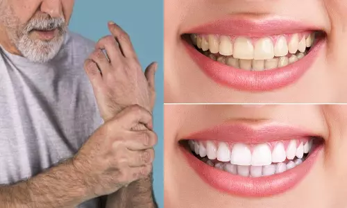 மூட்டுவலிக்கும் பற்களுக்கும் சம்பந்தம் இருப்பது தெரியுமா உங்களுக்கு...?