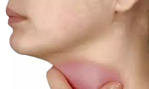 பொன்னேரி-மீஞ்சூர் பகுதியில் இருமல், தொண்டை வலியால் ஏராளமானோர் அவதி: ஆஸ்பத்திரிக்கு படையெடுக்கும் மக்கள்