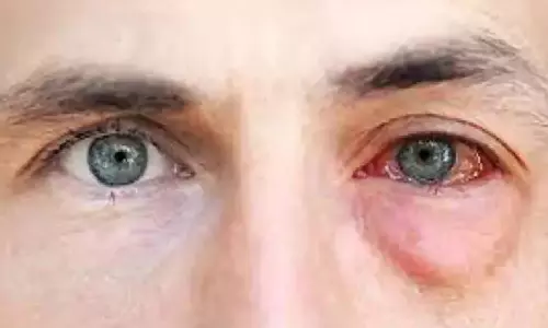 அதிக நேரம் கணினியை பார்ப்பவரா நீங்கள்? உங்களுக்கான அருமையான டிப்ஸ்....