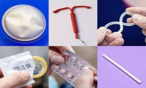 கருத்தடை பற்றி தெரிந்துகொள்ள வேண்டிய விஷயங்கள்!