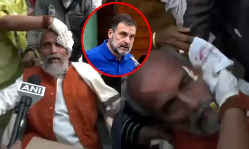 ராகுல் காந்தி தள்ளி விட்டதால் என் மண்டை உடைந்தது - பாஜக எம்.பி. குற்றச்சாட்டு