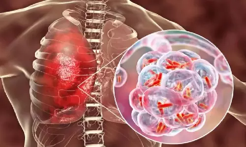 குளிர்காலத்தில் அதிகம் பரவும் `வாக்கிங் நிமோனியா