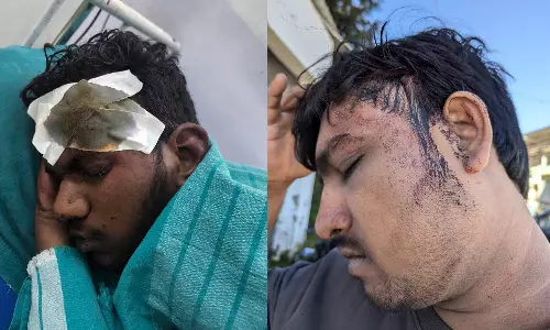 கொடைக்கானல் ஓட்டலில் சுற்றுலா பயணிகளை கடுமையாக தாக்கிய 6 பேர் கைது