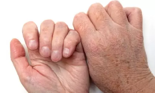 குளிர் காலங்களில் தோலில் ஏற்படும் வறட்சி... தடுக்க என்ன வழி?