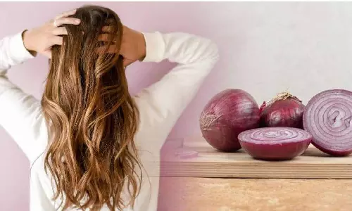 முடி அடர்த்தியாக வளர `வெங்காய ஹேர் மாஸ்க்