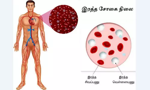 ரத்தசோகை ஏற்படுவது ஏன்?