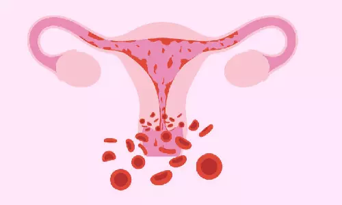 மாதவிடாய் காலத்தில் அதிக உதிரப்போக்கு ஏற்படுவது எதனால்?