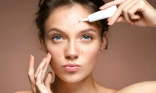 டீன்-ஏஜ் வயதினர் சரும பிரச்சனைகளை சமாளிக்க சில டிப்ஸ்...