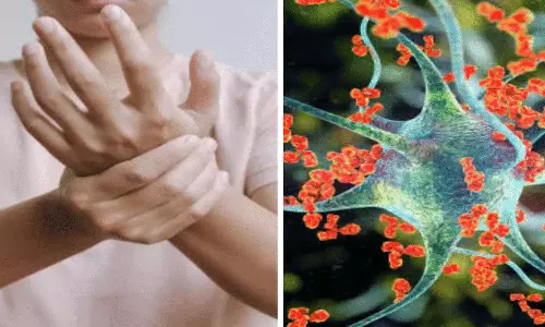 மகாராஷ்டிராவில் ஜிபிஎஸ் நோயால் பாதிக்கப்பட்ட ஒருவர் மரணம்- புனேயில் பாதிப்பு 101 ஆக உயர்வு