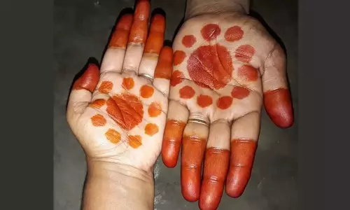 மருதாணி வைத்தால்...