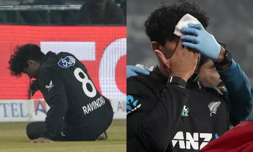 Video: முகத்தை பதம் பார்த்த பந்து.. இரத்த காயத்துடன் வெளியேறிய வீரர் - பரபரப்பு