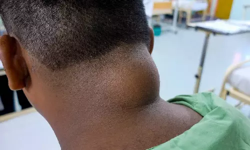 கொழுப்பு கட்டிகளை மாத்திரைகள் மூலம் கரைக்க முடியுமா?