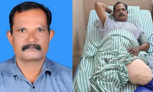 போலீசார் லத்தியால் தாக்கியதால் ஓய்வு பெற்ற விமானப்படை வீரரின் கால் அகற்றம்