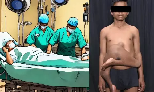 சிறுவனின் வயிற்றில் வளர்ந்த 2 கால்களை அகற்றி எய்ம்ஸ் மருத்துவர்கள் சாதனை