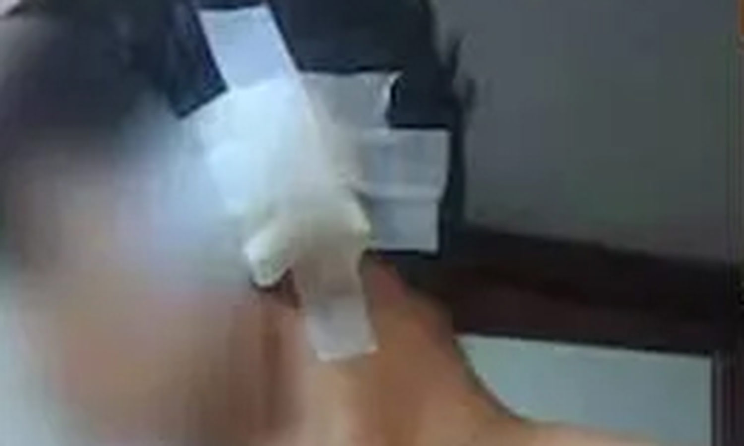 மாணவர்கள் தாக்கியதில் பிளஸ்-2 மாணவர் காது கிழிந்தது- பள்ளி நிர்வாகம் மீது பெற்றோர் புகார்