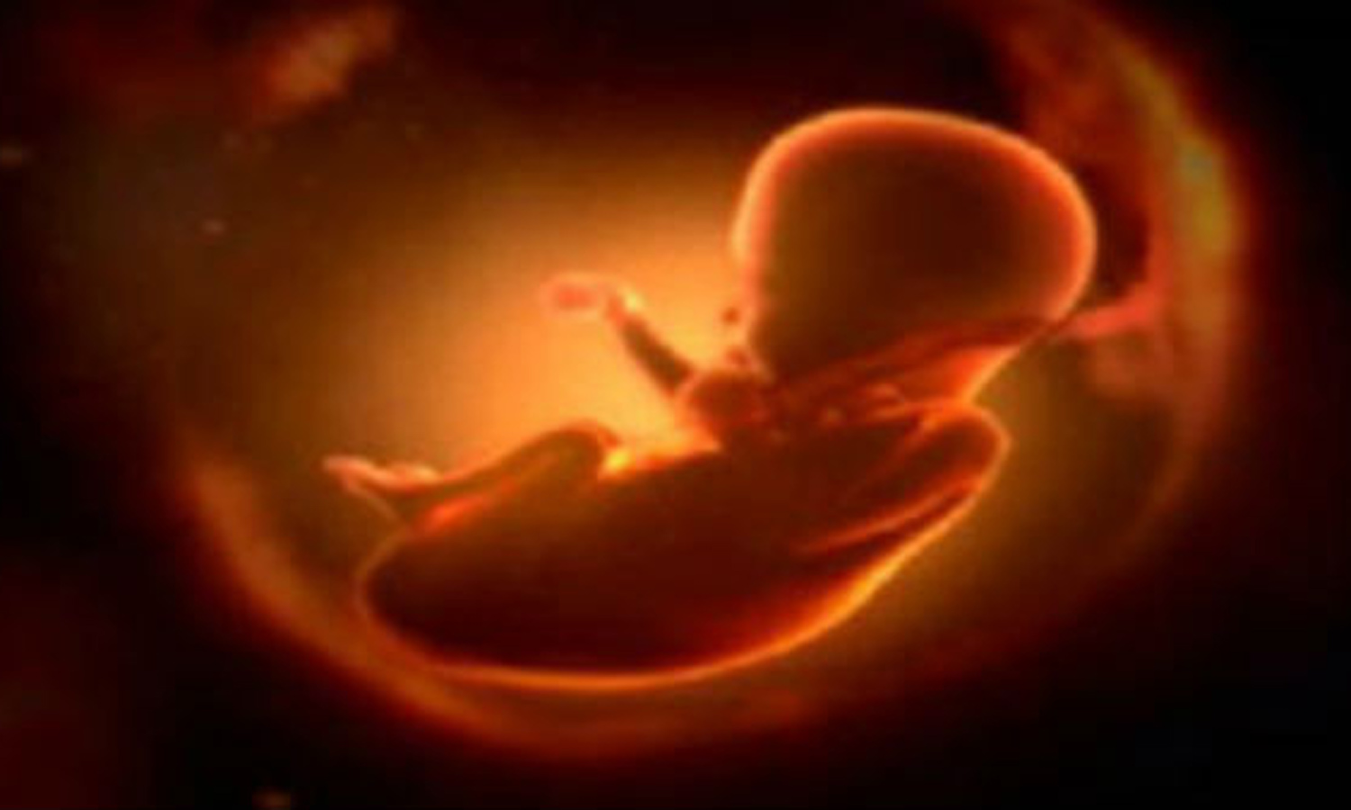 சேலத்தில் கருக்கலைப்பு செய்த 2 ஆஸ்பத்திரிகளை மூட உத்தரவு- சுகாதாரத்துறை அதிகாரிகள் நடவடிக்கை