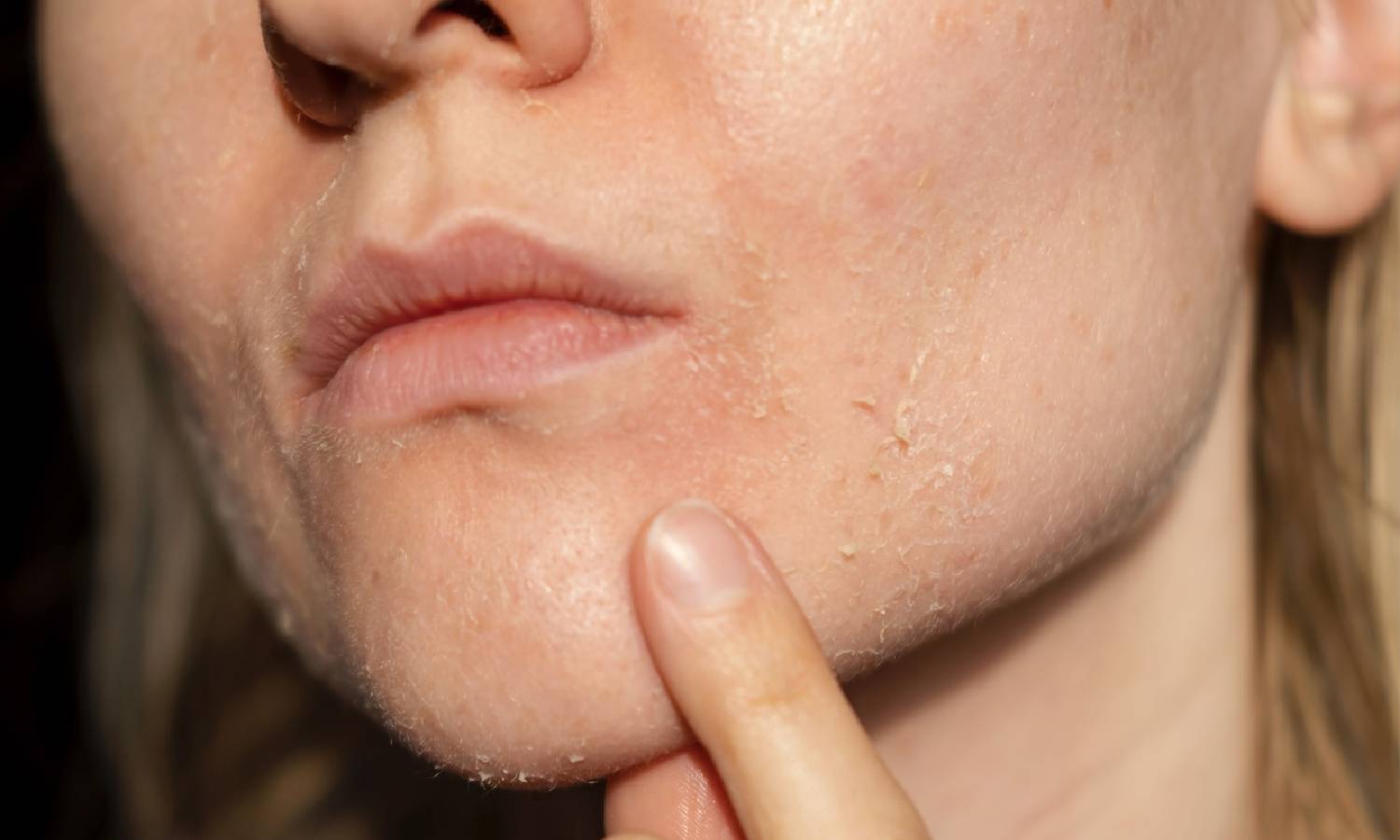 தோல் வறட்சி நீங்கி பளபளப்பாக இருக்க சாப்பிட வேண்டிய உணவுகள்!