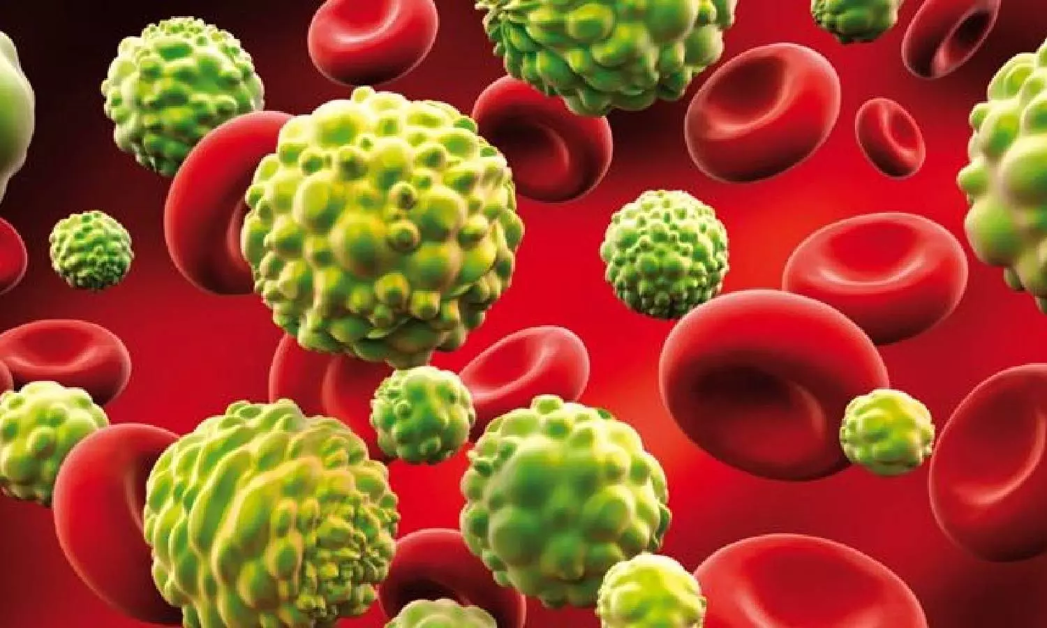 சித்த மருத்துவத்தில் ரத்த புற்றுநோய்க்கு சிகிச்சைகள் உள்ளதா?