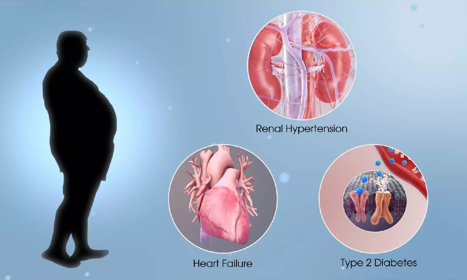 மெட்டபாலிக் சிண்ட்ரோம் என்றால் என்ன?