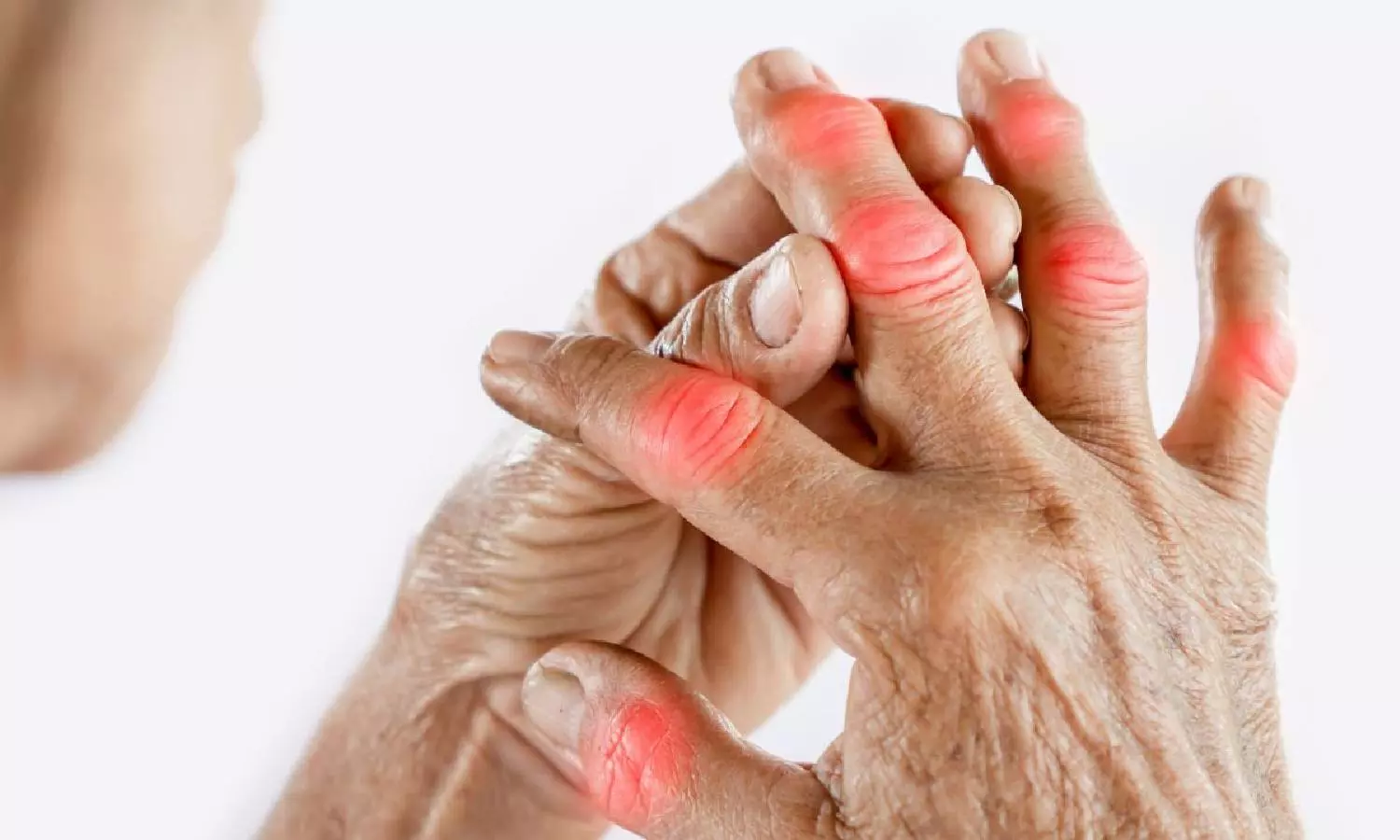 வாத நோயினால் கை, கால்கள் எதனால் வீக்கம் அடைகிறது தெரியுமா?