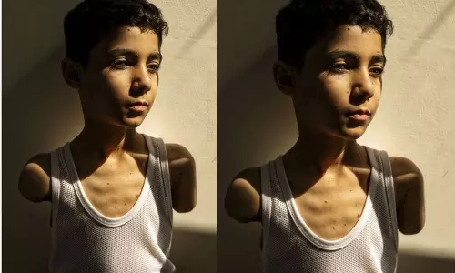 World Press Photo 2025 : இஸ்ரேல் தாக்குதலில் இரு கைகளையும் இழந்த 9 வயது காசா சிறுவனின் புகைப்படம்!