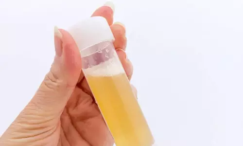 சிறுநீரில் வெள்ளை நுரை... ஆபத்தானதா?