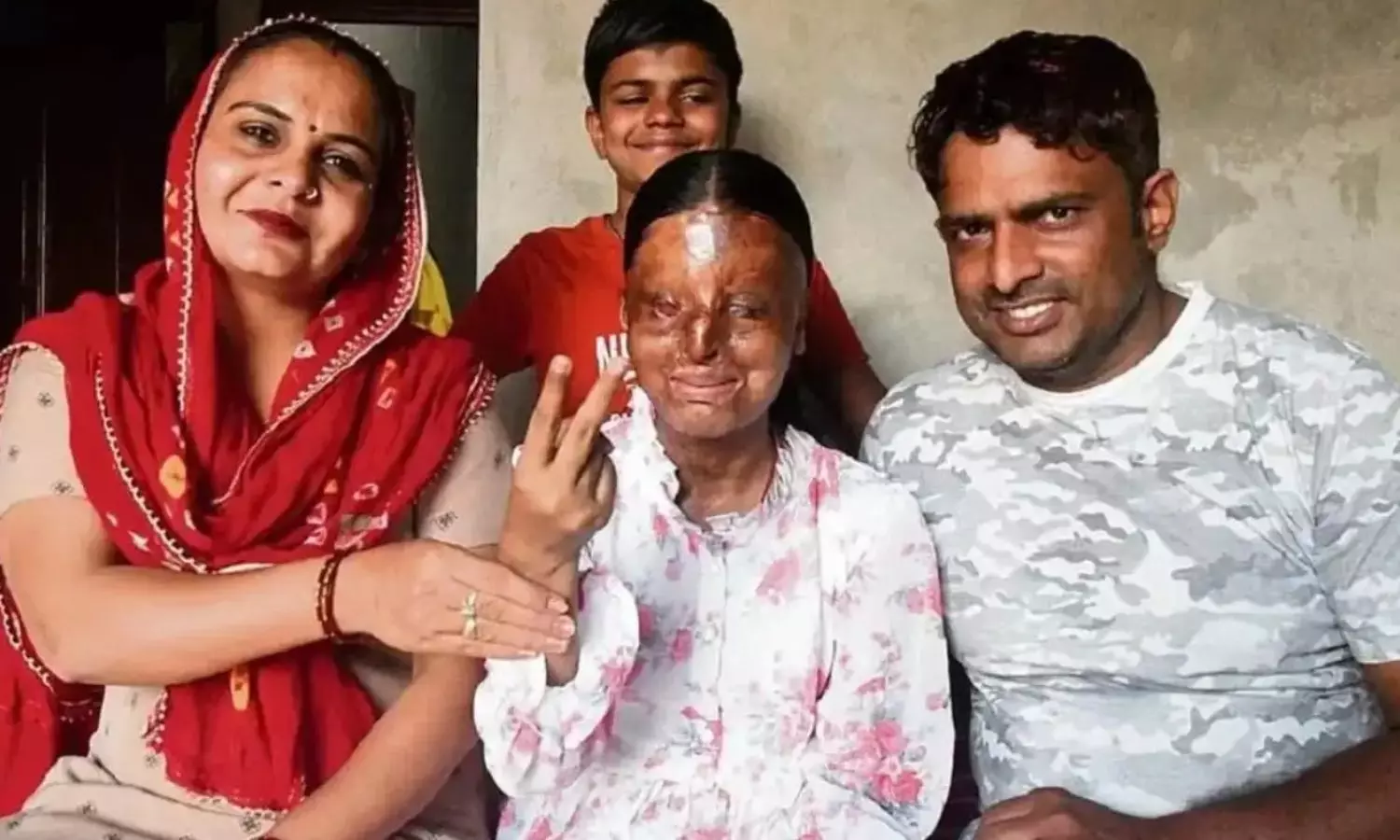 3 வயதில் ஆசிட் தாக்குதல்.. பார்வையிழந்த மாணவி 12ஆம் வகுப்பு பொதுத்தேர்வில் சாதனை!