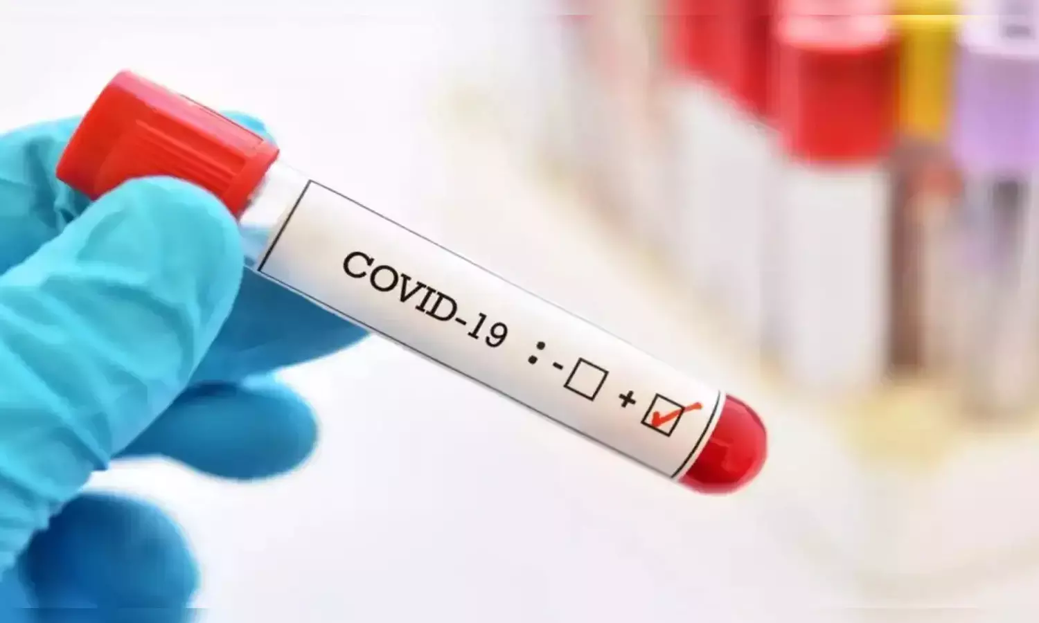 சென்னையில் கொரோனா தொற்று பாதிப்பால் ஒருவர் உயிரிழப்பு