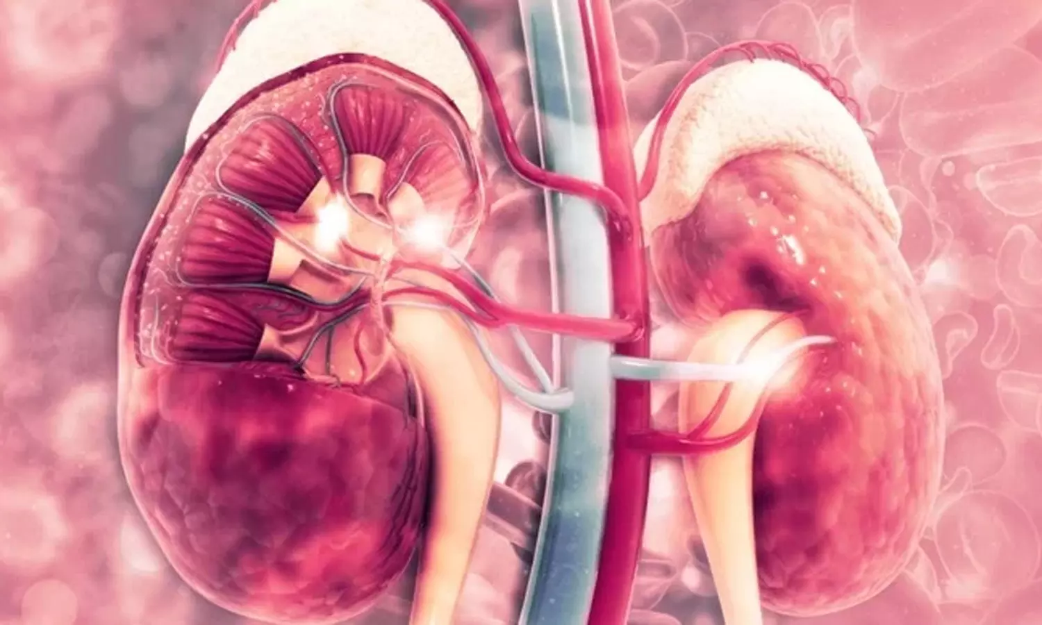 சிறுநீரகப் பாதிப்பு எதனால் ஏற்படுகிறது? சிறுநீரகப் பாதிப்பு எதனால் ஏற்படுகிறது?