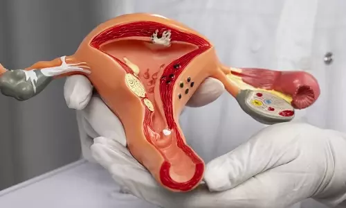 பெண்களை பாதிக்கும் கர்ப்பப்பை புற்றுநோய்க்கான காரணங்கள்