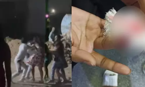 இரவில் இளம்பெண்களை வழிமறித்து தாக்கிய இளைஞர்கள்.. விரலை கடித்து துன்புறுத்தல் - வீடியோ