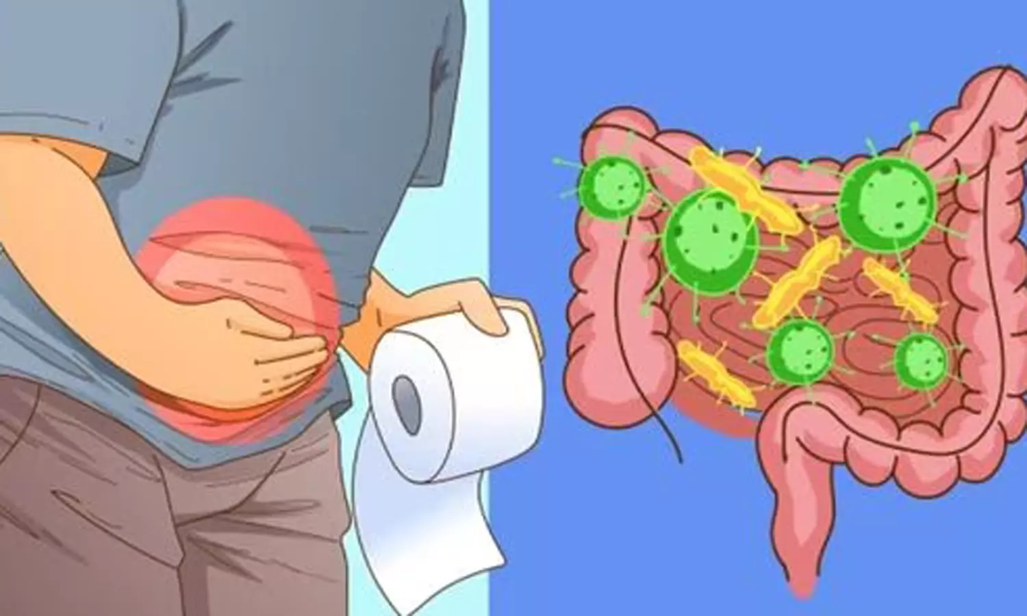 மலச்சிக்கல் காரணங்களும் தீர்வுகளும் மலச்சிக்கல் காரணங்களும் தீர்வுகளும்