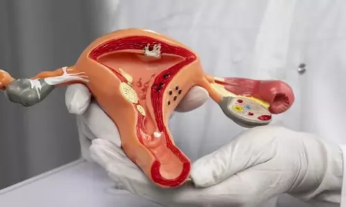 கர்ப்பப்பை எடுத்த பெண்களுக்கு பாலியல் பிரச்சினைகளுக்கு தீர்வு