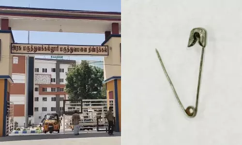 திண்டுக்கல்லில் சிறுமியின் குடலில் சிக்கிய சேப்டி பின் அகற்றம்