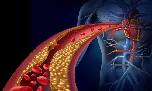 ரத்தக்கொழுப்பு அதிகரித்தால்...?