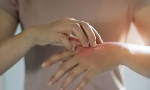 உடலில் அரிப்பை தடுக்கும் உணவுவகைகள்