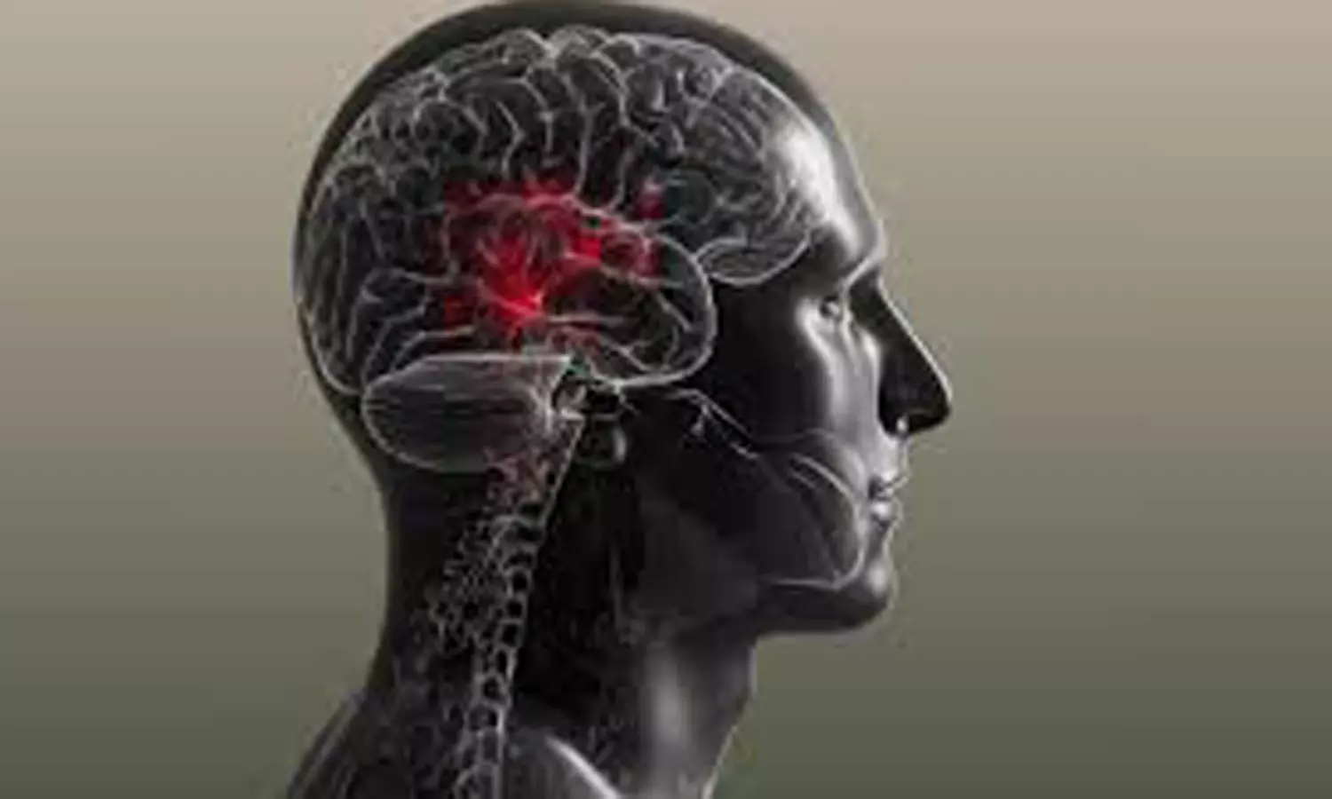 மூளை பாதிப்பும் வலிப்பும் மூளை பாதிப்பும் வலிப்பும்