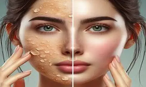 முகம் பளிச்சிட சில பயனுள்ள அழகு குறிப்புகள்...!