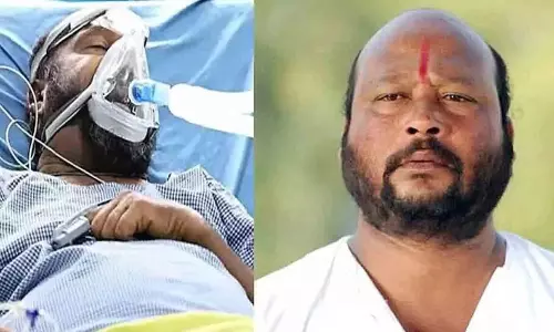 பிரபல தெலுங்கு காமெடி நடிகர் சிறுநீரக செயலிழப்பால் உயிரிழப்பு