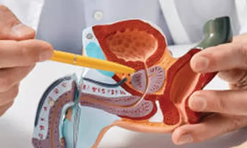 பெண்கள் சொல்ல தயங்கும் கருப்பை குடலிறக்கம்