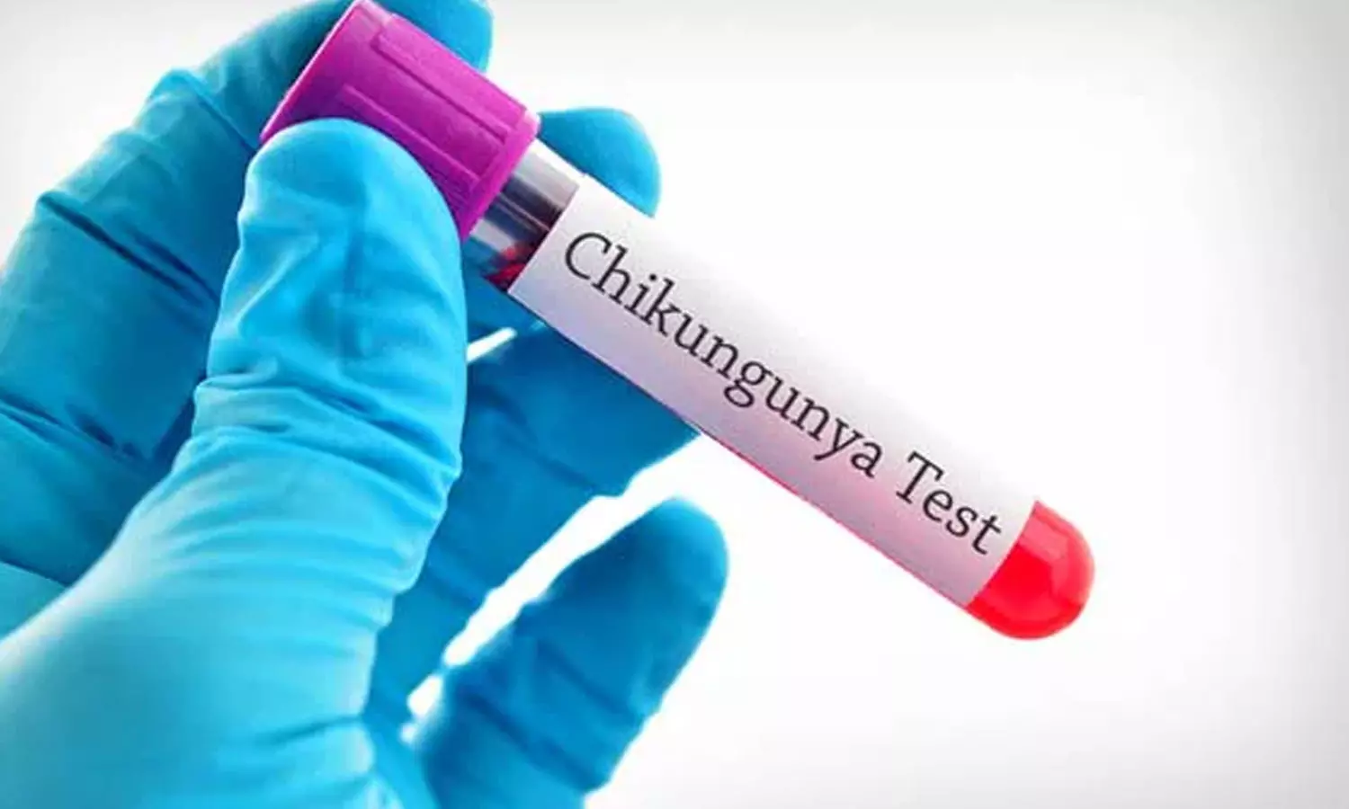 7 ஆயிரம் பேருக்கு சிக்குன்குனியா பாதிப்பு- சீன பயணத்தை தவிர்க்குமாறு அமெரிக்கா எச்சரிக்கை