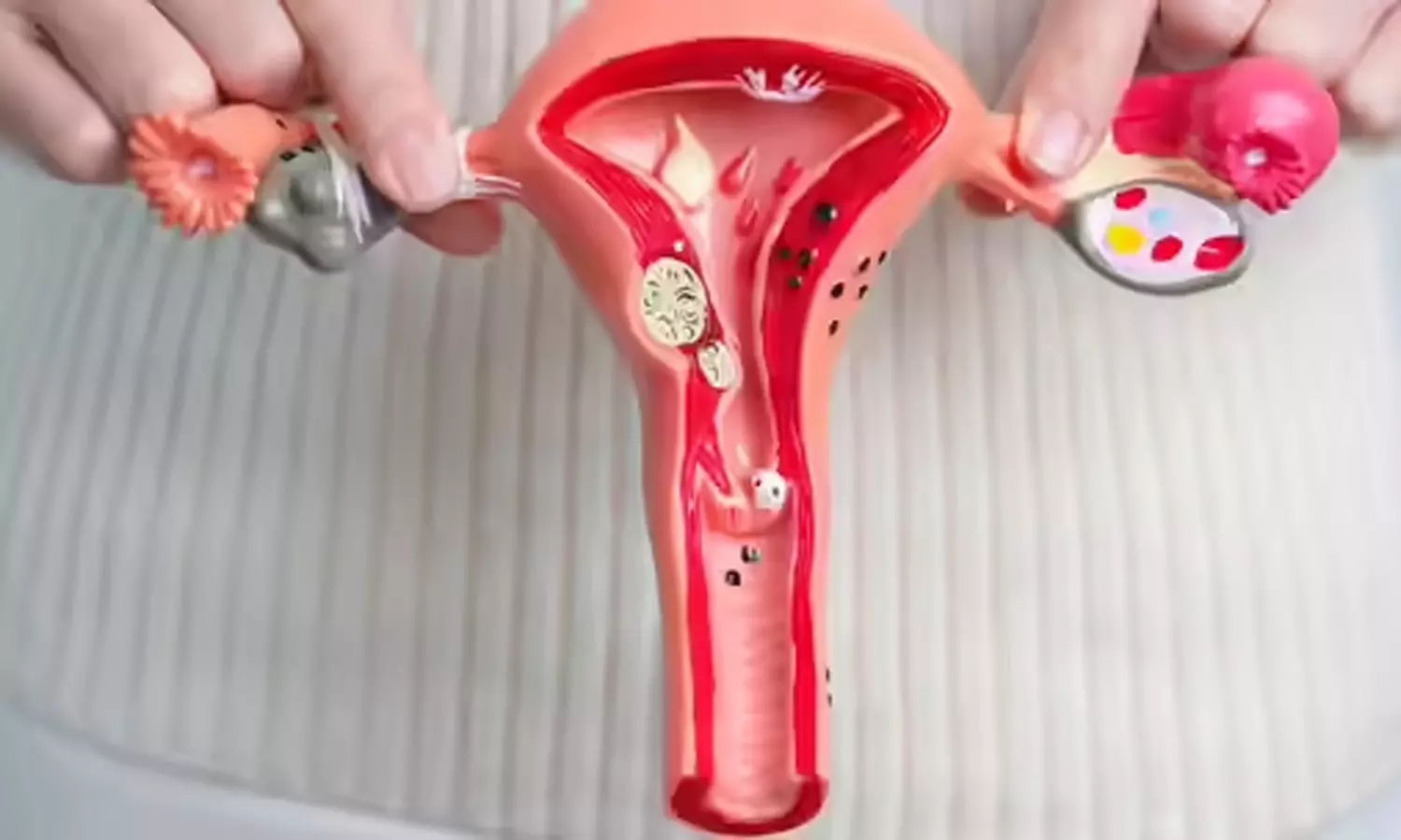 கருப்பை இறக்கம் வராமல் தடுக்கும் உடற்பயிற்சி - எளிய சிகிச்சைகள் கருப்பை இறக்கம் வராமல் தடுக்கும் உடற்பயிற்சி - எளிய சிகிச்சைகள்